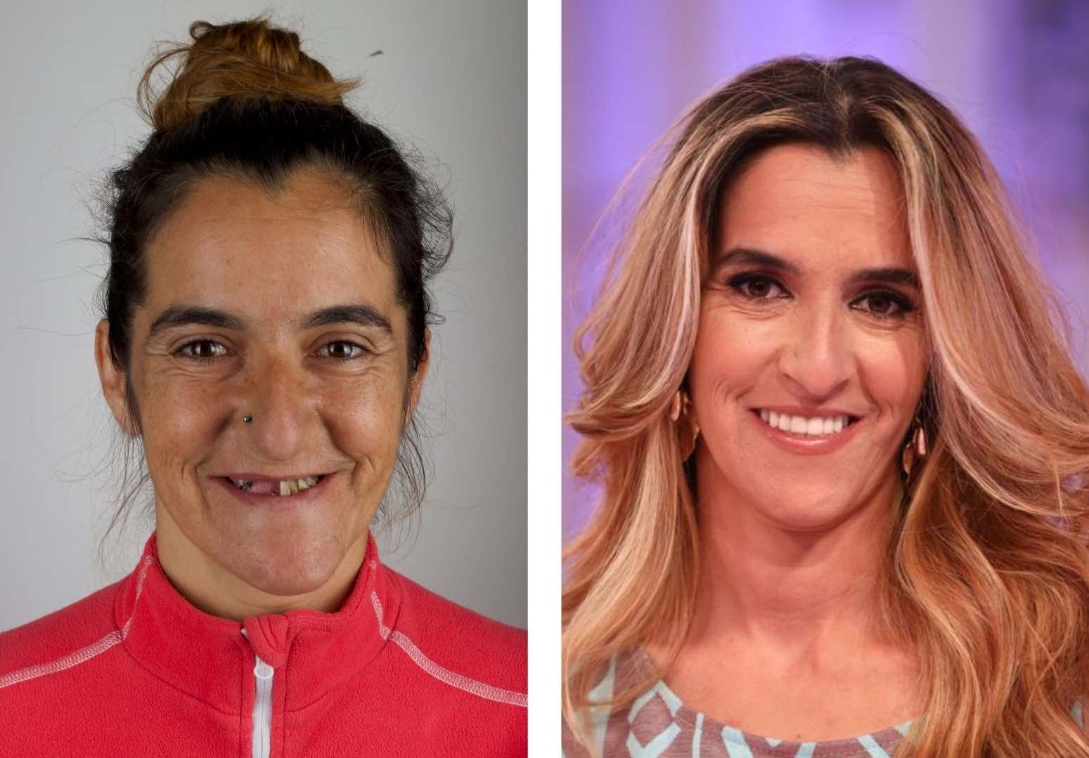 O novo sorriso da Raquel